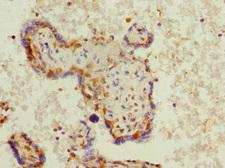 BCAP / PHF11 Antibody - Immunohistochemistry of paraffin-embedded human placenta tissue at dilution 1:100