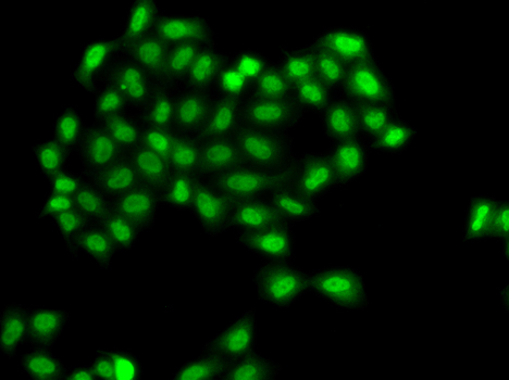 BCAP / PHF11 Antibody - Immunofluorescence analysis of A549 cells using PHF11 antibody.