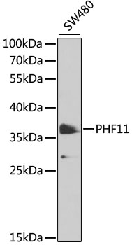 BCAP / PHF11 Antibody - Western blot analysis of extracts of SW480 cells, using PHF11 antibody at 1:1000 dilution. The secondary antibody used was an HRP Goat Anti-Rabbit IgG (H+L) at 1:10000 dilution. Lysates were loaded 25ug per lane and 3% nonfat dry milk in TBST was used for blocking. An ECL Kit was used for detection and the exposure time was 90s.