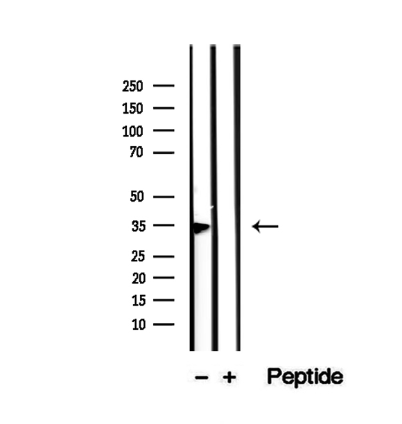BCAP / PHF11 Antibody - Western blot analysis of extracts of mouse thymus tissue using PHF11 antibody.