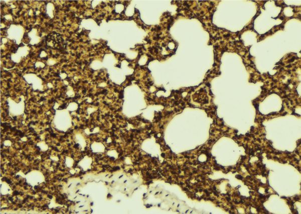 BCAP / PHF11 Antibody - 1:100 staining mouse lung tissue by IHC-P. The sample was formaldehyde fixed and a heat mediated antigen retrieval step in citrate buffer was performed. The sample was then blocked and incubated with the antibody for 1.5 hours at 22°C. An HRP conjugated goat anti-rabbit antibody was used as the secondary.