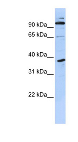 BCAP / PHF11 Antibody - PHF11 antibody Western blot of MCF7 cell lysate. This image was taken for the unconjugated form of this product. Other forms have not been tested.