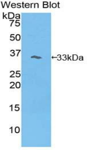 BCAP / PIK3AP1 Antibody - Western blot of recombinant BCAP / PIK3AP1.  This image was taken for the unconjugated form of this product. Other forms have not been tested.