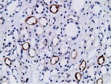 BCAP / PIK3AP1 Antibody - IHC of paraffin-embedded Human Kidney tissue using anti-PIK3AP1 mouse monoclonal antibody.