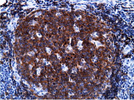 BCAP / PIK3AP1 Antibody - IHC of paraffin-embedded Human lymph node tissue using anti-PIK3AP1 mouse monoclonal antibody.