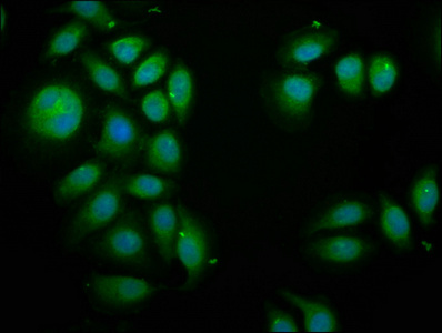 BCAP / PIK3AP1 Antibody - Immunofluorescence staining of A549 cells at a dilution of 1:100, counter-stained with DAPI. The cells were fixed in 4% formaldehyde, permeabilized using 0.2% Triton X-100 and blocked in 10% normal Goat Serum. The cells were then incubated with the antibody overnight at 4 °C.The secondary antibody was Alexa Fluor 488-congugated AffiniPure Goat Anti-Rabbit IgG (H+L) .