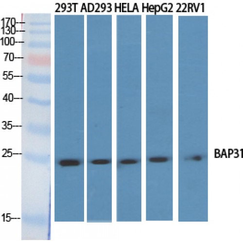 BCAP31 / BAP31 Antibody - Western blot of BAP31 antibody