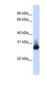 BCAP31 / BAP31 Antibody - BCAP31 / BAP31 antibody Western blot of 293T cell lysate. This image was taken for the unconjugated form of this product. Other forms have not been tested.