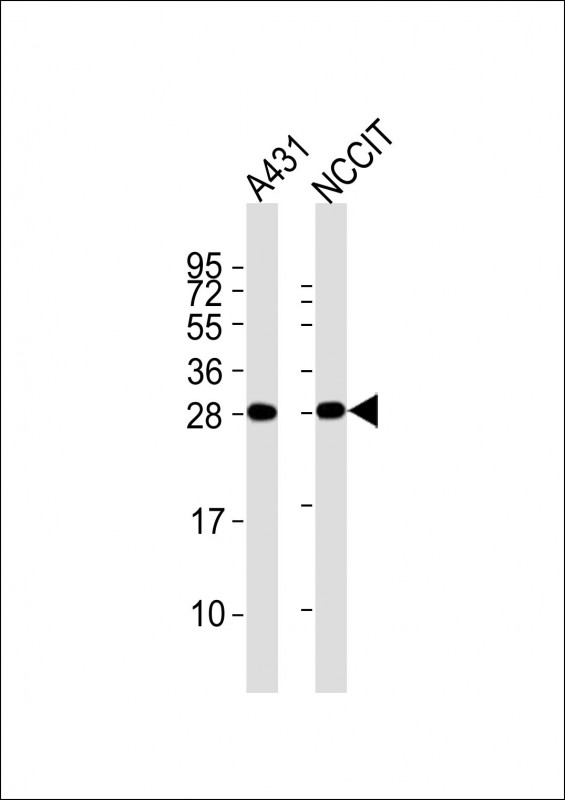 BCAP31 / BAP31 Antibody - All lanes : Anti-BAP31 Antibody at 1:2000 dilution Lane 1: A431 whole cell lysates Lane 2: NCCIT whole cell lysates Lysates/proteins at 20 ug per lane. Secondary Goat Anti-Rabbit IgG, (H+L), Peroxidase conjugated at 1/10000 dilution Predicted band size : 28 kDa Blocking/Dilution buffer: 5% NFDM/TBST.