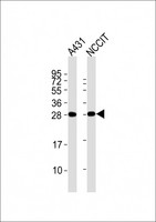 BCAP31 / BAP31 Antibody - All lanes : Anti-BAP31 Antibody at 1:2000 dilution Lane 1: A431 whole cell lysates Lane 2: NCCIT whole cell lysates Lysates/proteins at 20 ug per lane. Secondary Goat Anti-Rabbit IgG, (H+L), Peroxidase conjugated at 1/10000 dilution Predicted band size : 28 kDa Blocking/Dilution buffer: 5% NFDM/TBST.