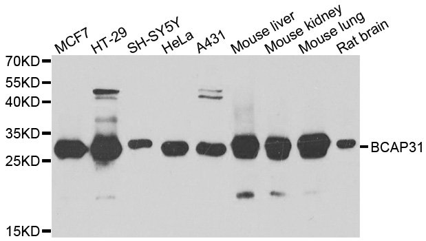 BCAP31 / BAP31 Antibody - Western blot analysis of extracts of various cell lines.