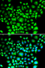 BCAP31 / BAP31 Antibody - Immunofluorescence analysis of U20S cells.