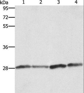 BCAP31 / BAP31 Antibody - Western blot analysis of Human placenta tissue and A549 cell, Raji and HeLa cell, using BCAP31 Polyclonal Antibody at dilution of 1:750.