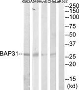 BCAP31 / BAP31 Antibody - Western blot analysis of extracts from HeLa, HuvEc, A549 and K562 cells, using BAP31 antibody.