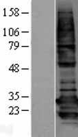 BCAP31 / BAP31 Protein - Western validation with an anti-DDK antibody * L: Control HEK293 lysate R: Over-expression lysate