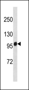 BCAR1 / p130Cas Antibody - MOUSE Bcar1 Antibody western blot of mouse heart tissue lysates (35 ug/lane). The MOUSE Bcar1 antibody detected the MOUSE Bcar1 protein (arrow).