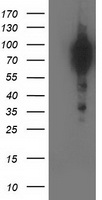 BCAR1 / p130Cas Antibody - HEK293T cells were transfected with the pCMV6-ENTRY control (Left lane) or pCMV6-ENTRY BCAR1 (Right lane) cDNA for 48 hrs and lysed. Equivalent amounts of cell lysates (5 ug per lane) were separated by SDS-PAGE and immunoblotted with anti-BCAR1.