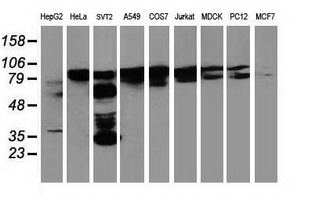 BCAR1 / p130Cas Antibody - Western blot of extracts (35ug) from 9 different cell lines by using anti-BCAR1 monoclonal antibody.