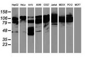 BCAR1 / p130Cas Antibody - Western blot of extracts (35 ug) from 9 different cell lines by using anti-BCAR1 monoclonal antibody.