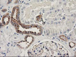 BCAR1 / p130Cas Antibody - IHC of paraffin-embedded Human Kidney tissue using anti-BCAR1 mouse monoclonal antibody.