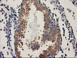 BCAR1 / p130Cas Antibody - IHC of paraffin-embedded Human endometrium tissue using anti-BCAR1 mouse monoclonal antibody.