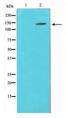 BCAR1 / p130Cas Antibody - Western blot of p130 Cas expression in NIH-3T3 whole cell lysates,The lane on the left is treated with the antigen-specific peptide.