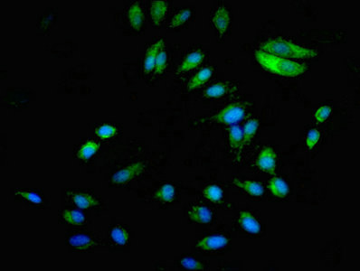 BCAR1 / p130Cas Antibody - Immunofluorescent analysis of Hela cells at a dilution of 1:100 and Alexa Fluor 488-congugated AffiniPure Goat Anti-Rabbit IgG(H+L)