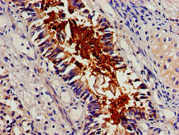 BCAR1 / p130Cas Antibody - Immunohistochemistry image of paraffin-embedded human lung tissue at a dilution of 1:100