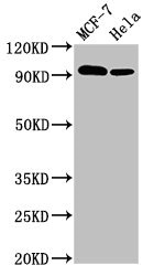 BCAR1 / p130Cas Antibody - Positive Western Blot detected in MCF-7 whole cell lysate, Hela whole cell lysate. All lanes: BCAR1 antibody at 3.4 µg/ml Secondary Goat polyclonal to rabbit IgG at 1/50000 dilution. Predicted band size: 94, 96, 78, 98 KDa. Observed band size: 94 KDa