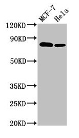 BCAR1 / p130Cas Antibody - Western Blot Positive WB detected in: MCF-7 whole cell lysate, Hela whole cell lysate All lanes: BCAR1 antibody at 3.4µg/ml Secondary Goat polyclonal to rabbit IgG at 1/50000 dilution Predicted band size: 94, 96, 78, 98 kDa Observed band size: 78 kDa