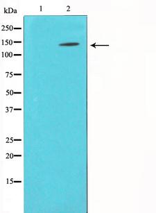 BCAR1 / p130Cas Antibody - Western blot analysis of p130 Cas expression in NIH-3T3 whole cells lysates. The lane on the left is treated with the antigen-specific peptide.