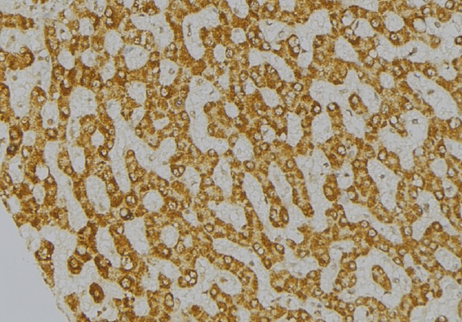 BCAR1 / p130Cas Antibody - 1:100 staining mouse liver tissue by IHC-P. The sample was formaldehyde fixed and a heat mediated antigen retrieval step in citrate buffer was performed. The sample was then blocked and incubated with the antibody for 1.5 hours at 22°C. An HRP conjugated goat anti-rabbit antibody was used as the secondary.