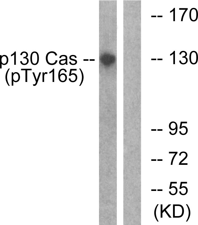 BCAR1 / p130Cas Antibody - Western blot analysis of lysates from HepG2 cells treated with EGF 200ng/ml 30', using p130 Cas (Phospho-Tyr165) Antibody. The lane on the right is blocked with the phospho peptide.