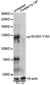BCAR1 / p130Cas Antibody - Western blot analysis of extracts of PC-12 cells, using Phospho-BCAR1-Y165 antibody at 1:1000 dilution. PC-12 cell lysate were treated by CIP (20ul CIP for each 400ul cell lysate) at 37â„ƒ for 1 hour. The secondary antibody used was an HRP Goat Anti-Rabbit IgG (H+L) at 1:10000 dilution. Lysates were loaded 25ug per lane and 3% nonfat dry milk in TBST was used for blocking. Blocking buffer: 3% BSA.An ECL Kit was used for detection and the exposure time was 90s.