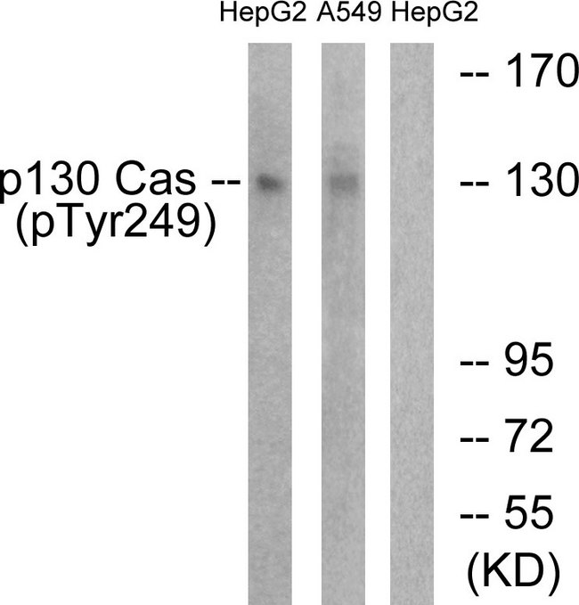 BCAR1 / p130Cas Antibody - Western blot analysis of lysates from HepG2 cells treated with EGF 200ng/ml 30' and A549 cells treated with PMA 125ng/ml 30', using p130 Cas (Phospho-Tyr249) Antibody. The lane on the right is blocked with the phospho peptide.