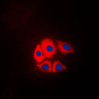 BCAR1 / p130Cas Antibody - Immunofluorescent analysis of p130 Cas (pY249) staining in NIH3T3 cells. Formalin-fixed cells were permeabilized with 0.1% Triton X-100 in TBS for 5-10 minutes and blocked with 3% BSA-PBS for 30 minutes at room temperature. Cells were probed with the primary antibody in 3% BSA-PBS and incubated overnight at 4 C in a humidified chamber. Cells were washed with PBST and incubated with a DyLight 594-conjugated secondary antibody (red) in PBS at room temperature in the dark. DAPI was used to stain the cell nuclei (blue).