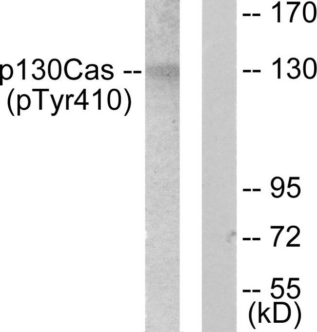 BCAR1 / p130Cas Antibody - Western blot analysis of lysates from NIH/3T3 cells, using p130 Cas (Phospho-Tyr410) Antibody. The lane on the right is blocked with the phospho peptide.