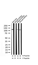 BCAR1 / p130Cas Antibody - Western blot analysis of Phospho-p130 Cas (Tyr410) expression in various lysates