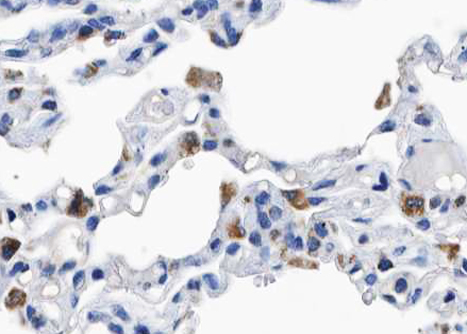 BCAR1 / p130Cas Antibody - 1:100 staining human lung tissue by IHC-P. The tissue was formaldehyde fixed and a heat mediated antigen retrieval step in citrate buffer was performed. The tissue was then blocked and incubated with the antibody for 1.5 hours at 22°C. An HRP conjugated goat anti-rabbit antibody was used as the secondary.