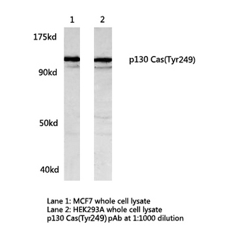 BCAR1 / p130Cas Antibody - Western blot of p130 Cas(Tyr249) pAb in extracts from MCF7, HEK293A and Raw264.7( treated with LPS) cells.