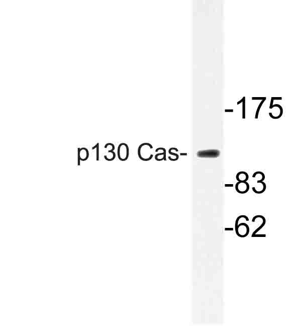 BCAR1 / p130Cas Antibody - Western blot of p130 Cas (V404) pAb in extracts from HUVEC cells.