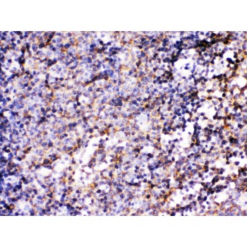 BCAR3 Antibody - BCAR3 was detected in paraffin-embedded sections of mouse lymphadenoma tissues using rabbit anti- BCAR3 Antigen Affinity purified polyclonal antibody at 1 ug/mL. The immunohistochemical section was developed using SABC method.