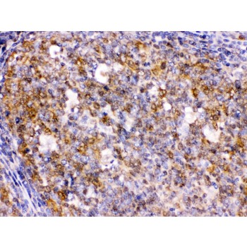BCAR3 Antibody - BCAR3 was detected in paraffin-embedded sections of human tonsil tissues using rabbit anti- BCAR3 Antigen Affinity purified polyclonal antibody at 1 ug/mL. The immunohistochemical section was developed using SABC method.