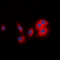 BCAR3 Antibody - Immunofluorescent analysis of BCAR3 staining in MCF7 cells. Formalin-fixed cells were permeabilized with 0.1% Triton X-100 in TBS for 5-10 minutes and blocked with 3% BSA-PBS for 30 minutes at room temperature. Cells were probed with the primary antibody in 3% BSA-PBS and incubated overnight at 4 deg C in a humidified chamber. Cells were washed with PBST and incubated with a DyLight 594-conjugated secondary antibody (red) in PBS at room temperature in the dark. DAPI was used to stain the cell nuclei (blue).