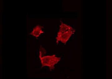 BCAR3 Antibody - Staining HeLa cells by IF/ICC. The samples were fixed with PFA and permeabilized in 0.1% Triton X-100, then blocked in 10% serum for 45 min at 25°C. The primary antibody was diluted at 1:200 and incubated with the sample for 1 hour at 37°C. An Alexa Fluor 594 conjugated goat anti-rabbit IgG (H+L) Ab, diluted at 1/600, was used as the secondary antibody.