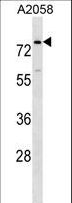 BCAS1 / NABC1 Antibody - BCAS1 Antibody western blot of A2058 cell line lysates (35 ug/lane). The BCAS1 antibody detected the BCAS1 protein (arrow).