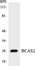 BCAS2 Antibody - Western blot analysis of the lysates from HUVECcells using BCAS2 antibody.