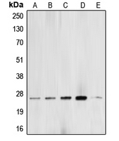 BCAS2 Antibody - Western blot analysis of BCAS2 expression in MCF7 (A); A549 (B); SHSY5Y (C); PC12 (D); NIH3T3 (E) whole cell lysates.