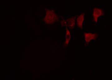 BCAS2 Antibody - Staining HeLa cells by IF/ICC. The samples were fixed with PFA and permeabilized in 0.1% Triton X-100, then blocked in 10% serum for 45 min at 25°C. The primary antibody was diluted at 1:200 and incubated with the sample for 1 hour at 37°C. An Alexa Fluor 594 conjugated goat anti-rabbit IgG (H+L) antibody, diluted at 1/600, was used as secondary antibody.