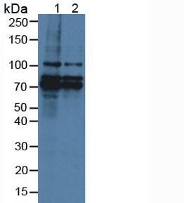 BCAS3 Antibody - Western Blot; Sample: Lane1: Human Hela Cells; Lane2: Human MCF7 Cells.